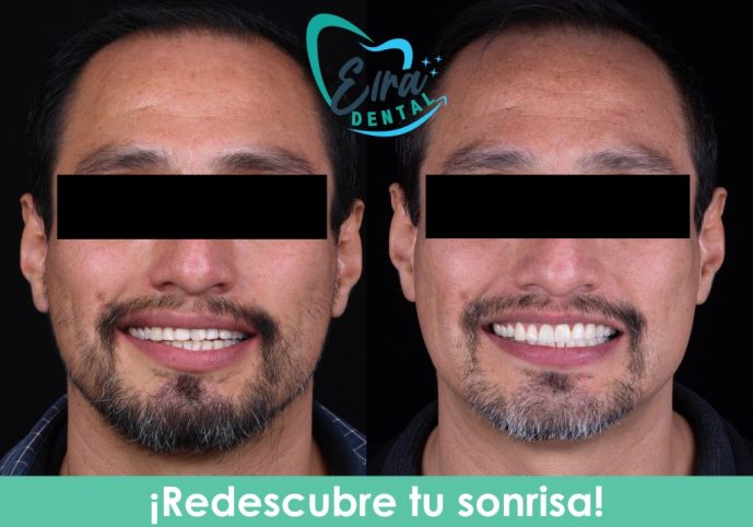 Redescubre tu sonrisa 2